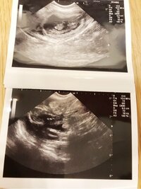 杉浦太陽『ご報告^_^』