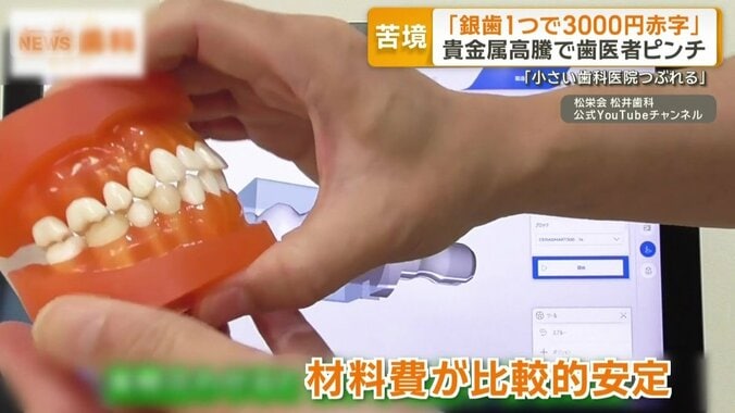 歯科医療の現場に浸透しているが…