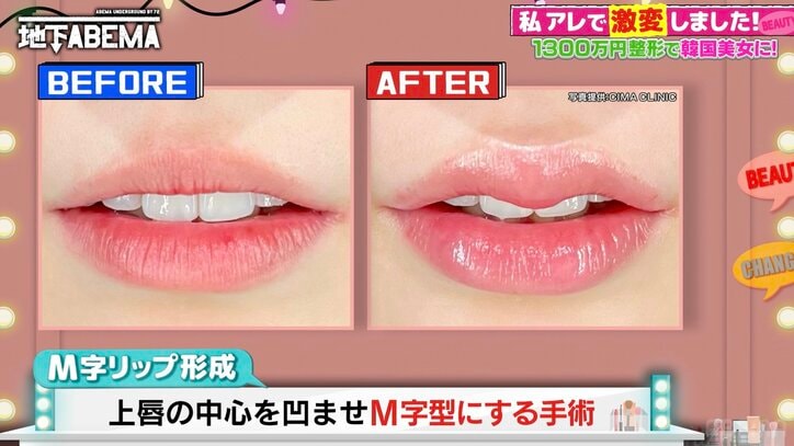 【写真・画像】稲垣吾郎の整形シミュレーションにツッコミの声「バランスが大事!」 2枚目