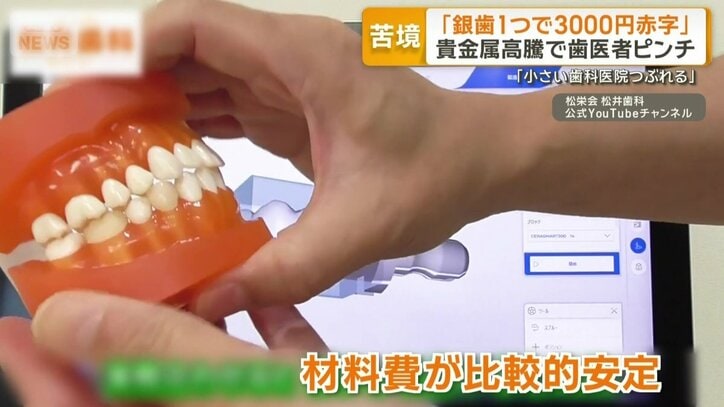 歯科医療の現場に浸透しているが…