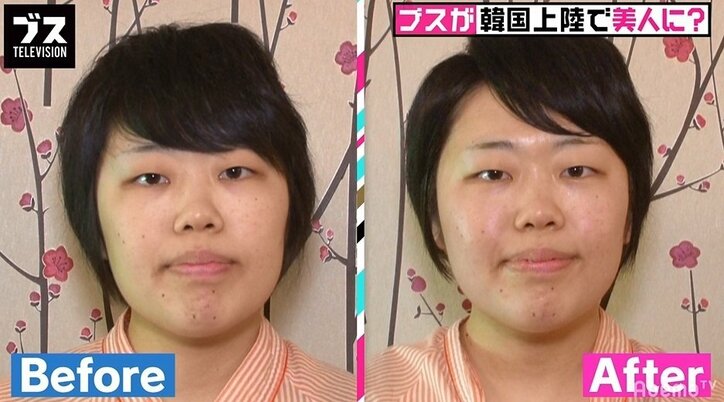 スピワゴ小沢、韓国の整形外科医の衝撃発言を紹介「顔を見たら、どこを直せばアイドルになれるのかわかる」