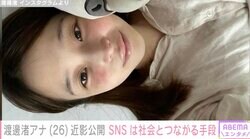休養中の渡邊渚アナ、最新ショット公開「同じように病気に悩む人たちとのコミュニケーションの場に」SNSは社会とつながるツール