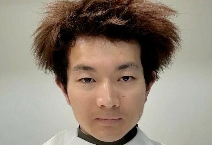 【写真・画像】何度カットしても剛毛ビフォーに戻る男、幼少期の写真に驚きの声「突然変異！」　1枚目