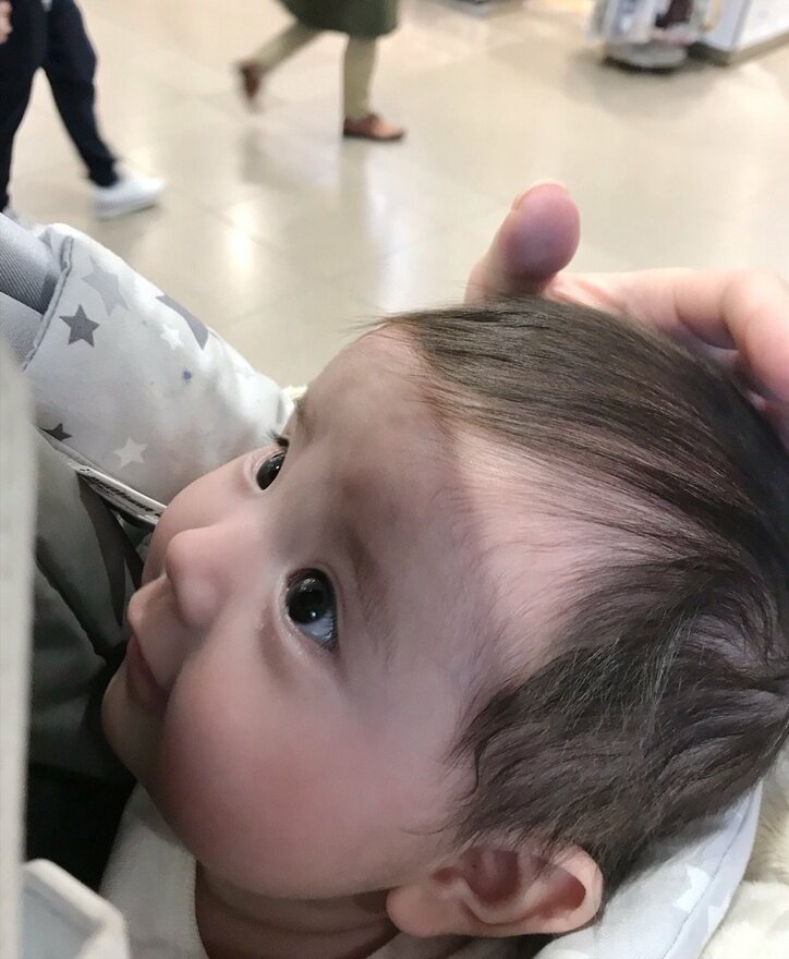 相沢まき 娘が3 4か月健診で 血管腫 と診断 異所性蒙古斑と別 話題 Abema Times 相沢まき 娘が3 4か月健診で 血管腫 と診断 異所性蒙古斑と別 話題 Abema Times