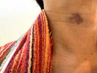 東MAX『病気のサイン❓誰かおせーて！』