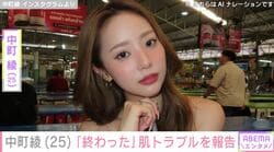 “中町兄妹”中町綾（25）、スキンケアトラブルを報告「肌終わった」
