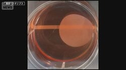 “仮免許”→“本免許”への道のりは？世界初『iPS細胞由来』条件付き承認へ