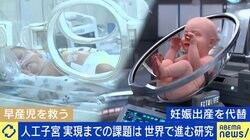 早産児の救命を 「人工子宮」研究に期待の声、一方で生命倫理の問題も 「“重症の新生児にもっと良い治療はないか？”という医療現場の願いから始まった研究だ」