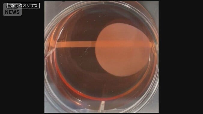 “仮免許”→“本免許”への道のりは？世界初『iPS細胞由来』条件付き承認へ 1枚目