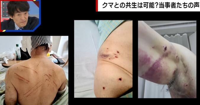 湊屋啓二さん、クマ被害にあった直後の様子