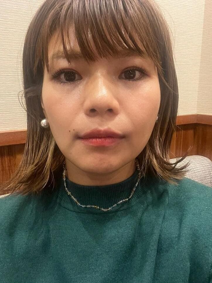  あいのり・クロ、顎関節症について検査した結果を報告「顎の骨の長さが左右違う」 