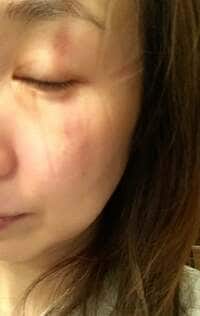 森口博子『ポンコツ祭り』