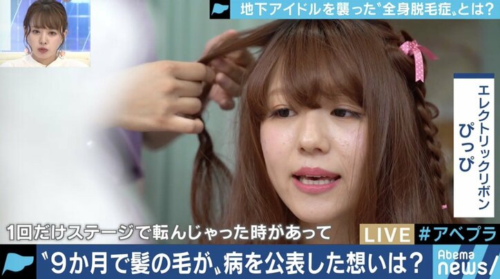 頭が丸くても続けたい 全身脱毛症アイドル 告白の裏にファンの後押しも 国内 Abema Times