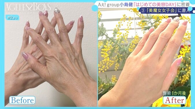 「年齢に違和感ある」 “奇跡の61歳”女性とAぇ! group小島健が対面「めちゃくちゃキレイ！」 3枚目