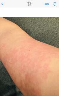 小泉貴之『今回は特にしんどそうです』