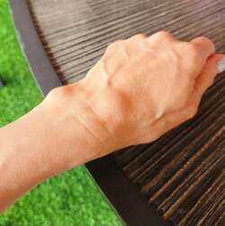  モト冬樹、妻・武東由美の手の甲に現れた症状「付き添って整形外科で切開手術をしたこともある」 