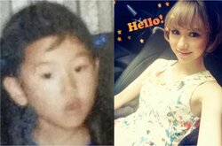 「14歳で初整形」“第二のローラ”としてブレイクした34歳タレント、整形前の写真に驚きの声「誰！？」