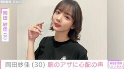 “役満ボディー”岡田紗佳、腕のアザに心配の声「痛々しいお大事に」「大事なお肌が…」