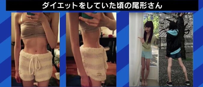 元モー娘。尾形春水も走った過激ダイエット 男性や子どもの患者も増加する「摂食障害」 6枚目