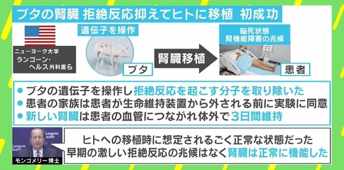 ブタからヒトへ“腎臓移植”米チームが成功 脳死状態で実施も…生命倫理に問題は？ 1枚目