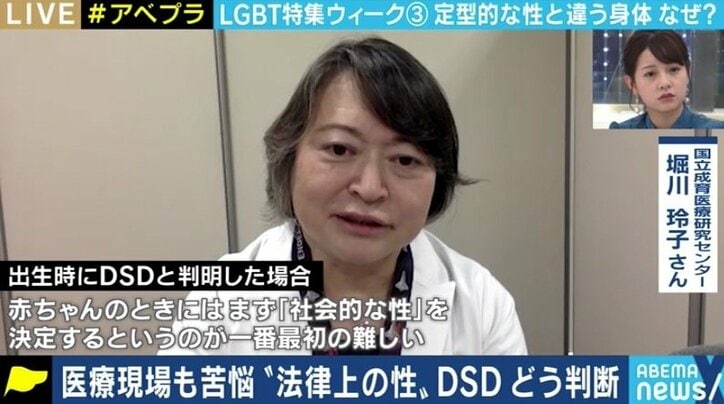 身体の性に関わる部分が多くの人と異なる「性分化疾患(DSD)」 サポート不足に悩む当事者たち
