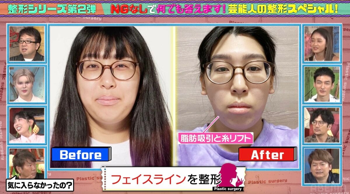 ゆめっちエロ画像 3時のヒロイン・ゆめっちの美容整形ビフォーアフターに驚きの声「これゆめっち！？」費用総額も告白 | バラエティ | ABEMA TIMES |  アベマタイムズ