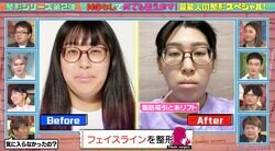 3時のヒロイン・ゆめっちの美容整形ビフォーアフターに驚きの声「これゆめっち！？」費用総額も告白