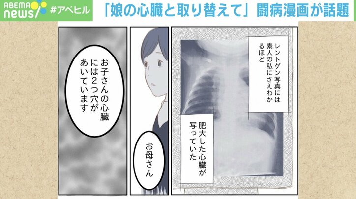 泣いた後にすごく顔が青くなって… 心疾患の闘病生活を描いた漫画 作者「娘の心臓と取り替えて」