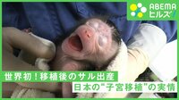【映像】世界初!子宮移植後のサル出産に成功