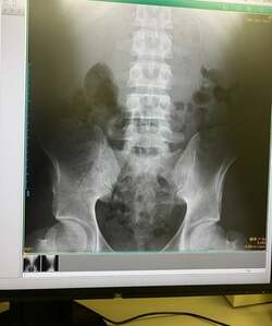  ネイボール、白血病と診断を受ける前に見舞われていた症状「凄く怒られて、初めて血液内科に行き」 