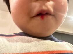  あいのり・桃、食事中に長男の口の中が血だらけになって驚愕「これは要注意だ」 