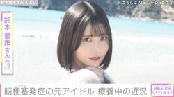脳梗塞を発症し手術を受けた元SKE48・鈴木愛來さん（19）、「注射の痕は23カ所」「頭には大きな傷」療養中の近況を報告