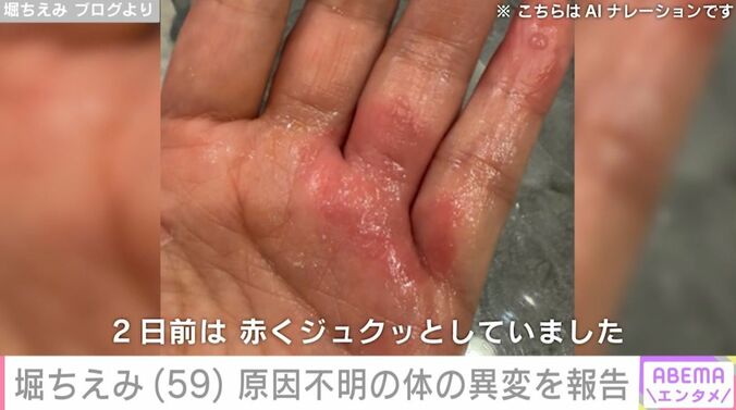 堀ちえみの手
