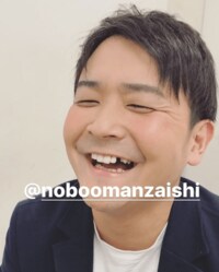 千鳥ノブ、虫歯で歯が抜けるも「かわいい」と話題に　「赤ちゃんみたい」