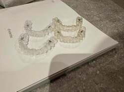 元あいのりメンバー、3週間インビザラインを続けて気付いたこと「こんなに色が変わってた」 