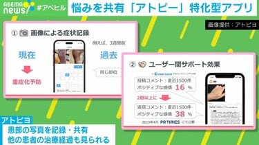 日本初、アトピー専用の匿名SNSアプリ なぜ、“悩み”も共有？開発者の