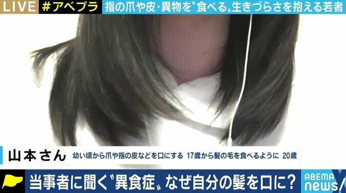 いけないと分かっていても…緊張や不安などを感じると爪や髪の毛を食べてしまう「異食症」の女性 4枚目