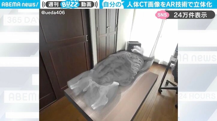 人体CT画像を“AR技術で立体化”