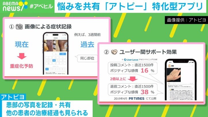 日本初、アトピー専用の匿名SNSアプリ なぜ、“悩み”も共有?開発者の思い「患者さん同士で励まし合うこともできる」