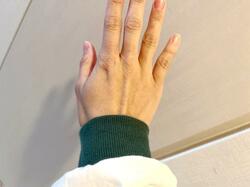  ノンスタ石田の妻、痛みが出て半分までしか曲げられない状態の指「無理しないでね」「お大事に」の声 