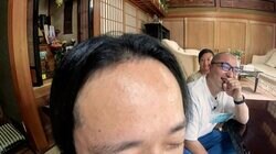 父親のハゲは遺伝する？薄毛に悩む6人兄弟…60歳をシミュレーションした“衝撃の姿”に爆笑