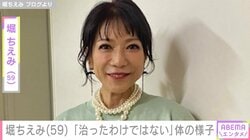 2019年に舌がん公表・堀ちえみ（59）「治ったわけではない」体の様子を報告