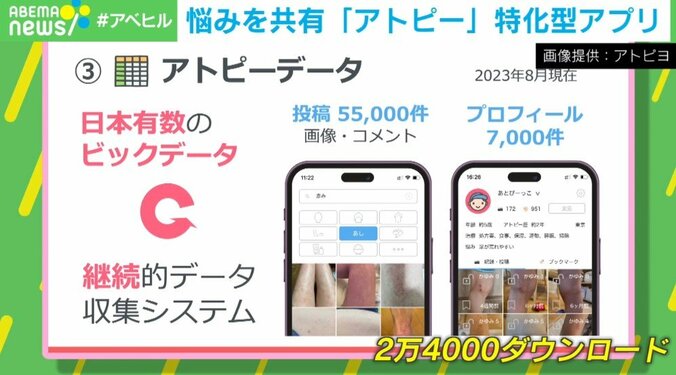 日本初、アトピー専用の匿名SNSアプリ なぜ、“悩み”も共有？開発者の思い「患者さん同士で励まし合うこともできる」 3枚目