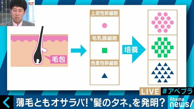 2020年には薄毛治療に革新？日本の再生医療技術がついに“髪のタネ”を発明 3枚目