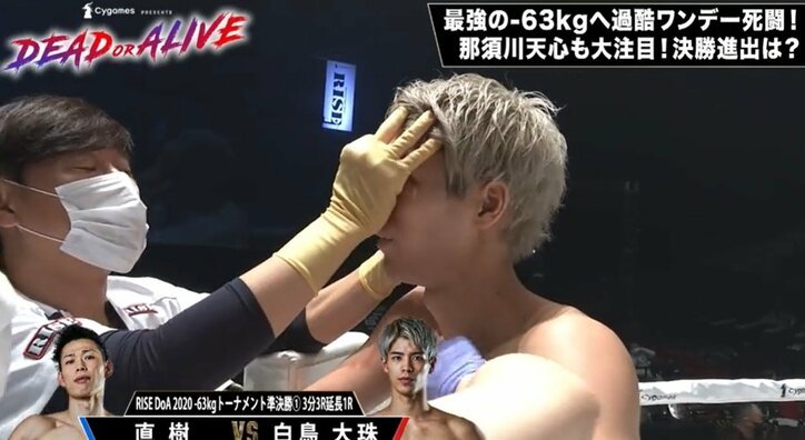 那須川天心は「格闘人生2周目の感じ」 同門・白鳥の衝撃敗戦を受け「これだから格闘技は面白い」発言が話題