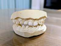 田代沙織『歯の矯正、はじめました』