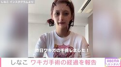 “ベビタピ店長”しなこ、ワキガ手術を公表した理由明かす「『悩んでる人が自分だけじゃないんだ！』って思ってくれたら」