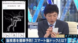 20分で検査、結果をスマホで確認できる「スマート脳ドック」が人気　病気の前兆「未病」の把握に注目