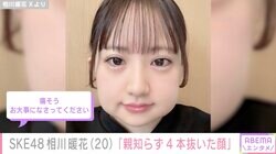 「親知らず4本抜いた」SKE48相川暖花、衝撃的な顔公開に反響「思った以上にパンパン」「しょくぱんまん」