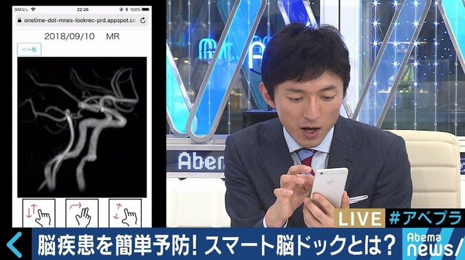 20分で検査、結果をスマホで確認できる「スマート脳ドック」が人気　病気の前兆「未病」の把握に注目 1枚目